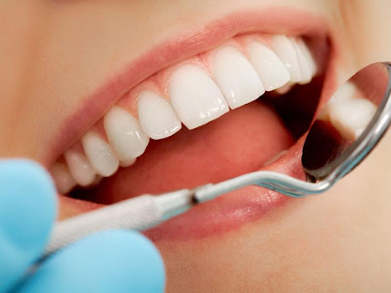 Що таке ремінералізація зубів