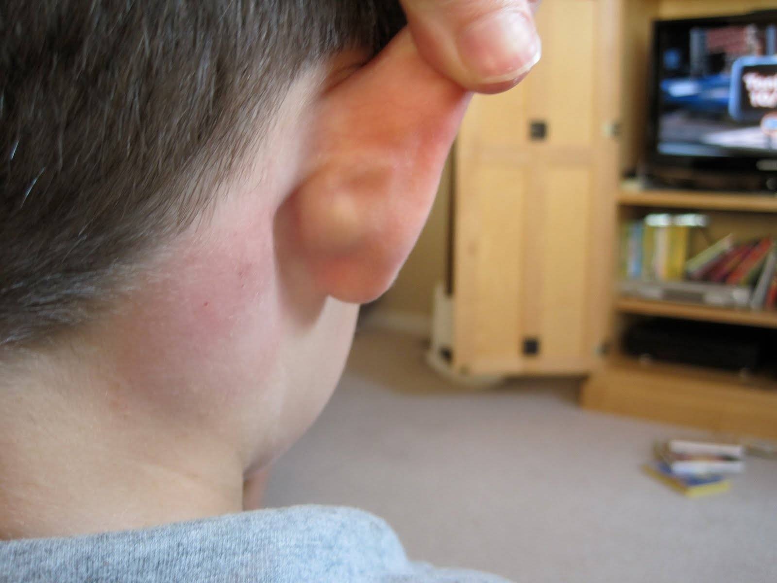 Шишка за вухом дитини: причини виникнення